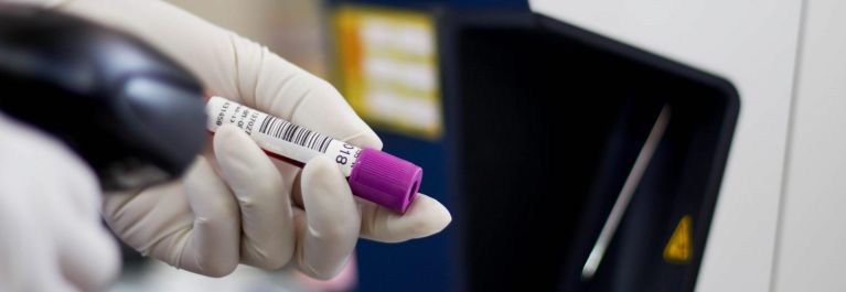 Scan des Barcodes eine Probe für ein Medizinprodukt