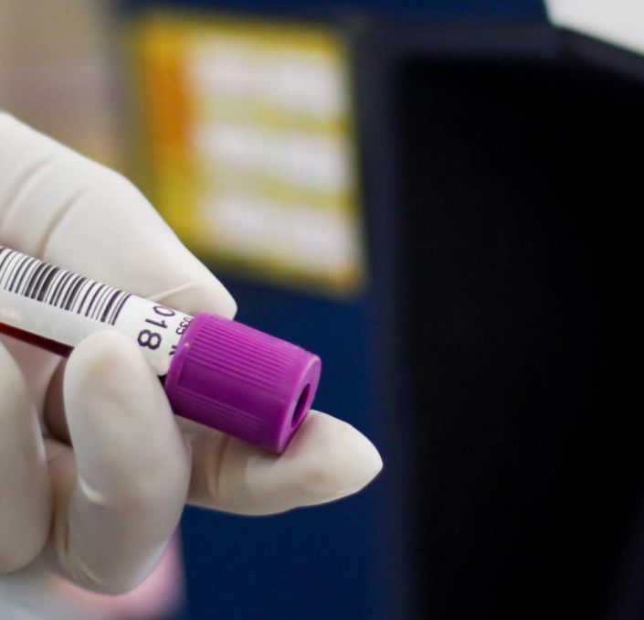 Scan des Barcodes eine Probe für ein Medizinprodukt